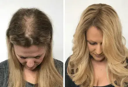 Resultado 3 - Antes e Depois